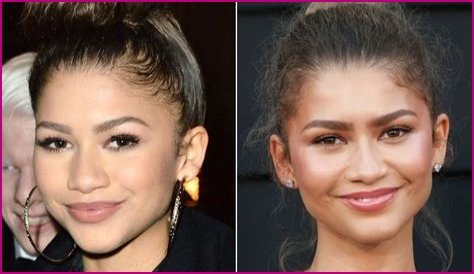 Unveiling The Truth: Zendaya's Plastic Surgery Journey